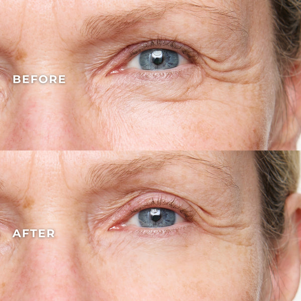 WUNDERLIFT 60 Second Wrinkle Reducer